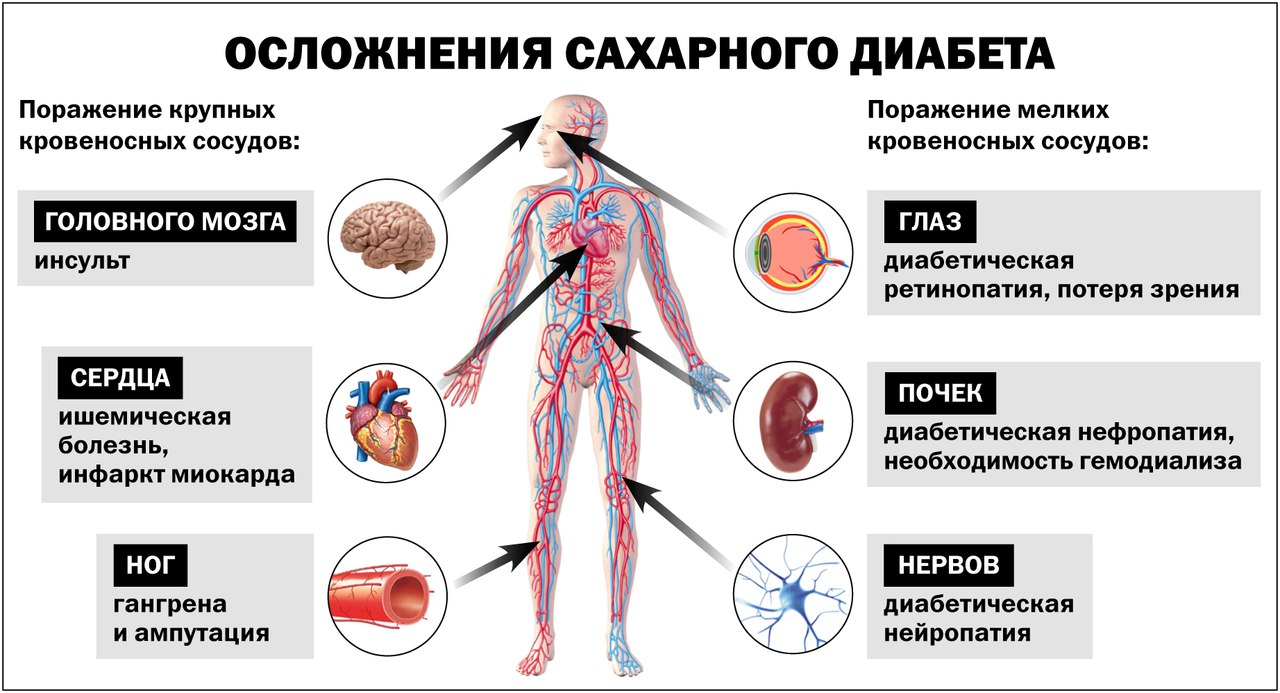 Осложнения при Сахарном диабете